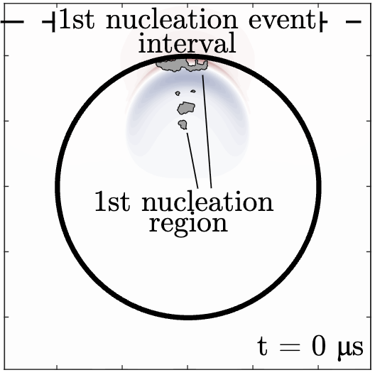 lab_tagawayo's tweet photo. Our paper ("Cavitation by phase shift of focused shock waves inside a droplet") is now available on @arxiv!
πCheck it out: https://t.co/Fsq3dCxRyU
#Cavitation #ShockWaves #DrugDelivery #Ultrasound #GouyPhaseShift https://t.co/24gmmGFFDc