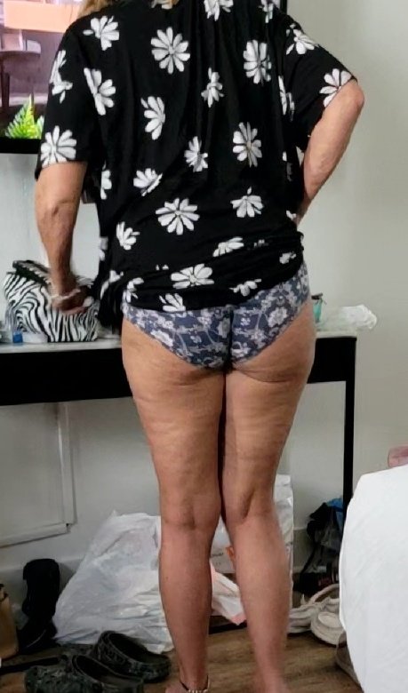 Al_n_Peg3 tweet media