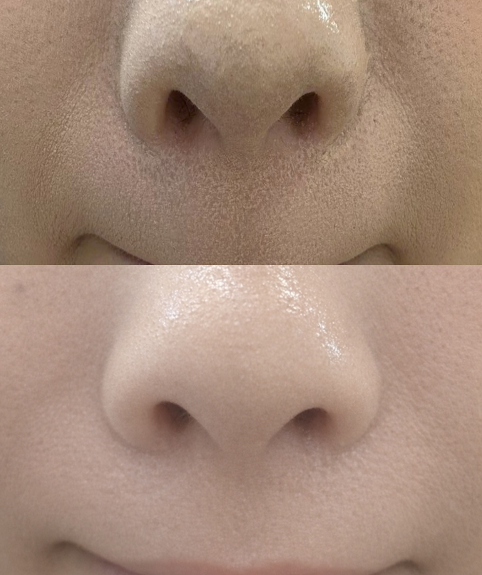 えりちゃま tweet media