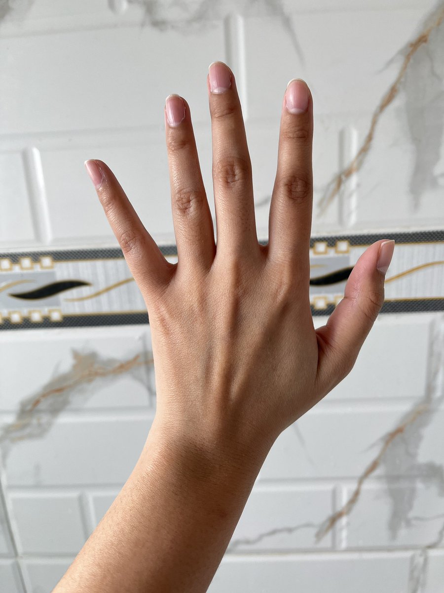 Juwi 🌻🌻 tweet media