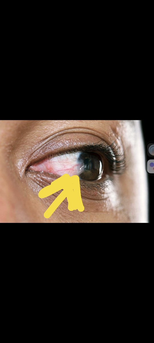 N'wanati tweet media