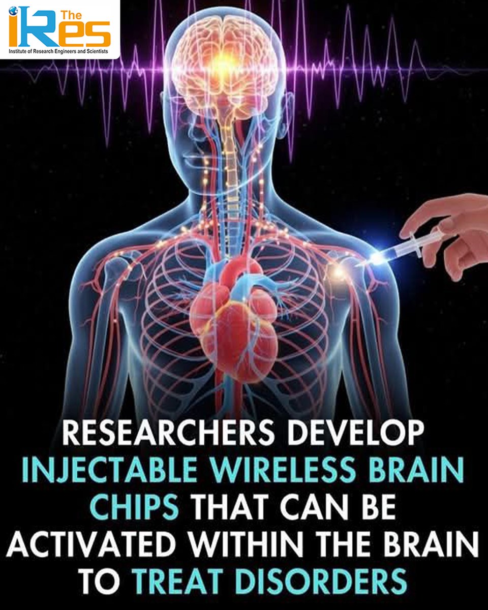 🧠 Revolutionizing Healthcare with Brain Technology

Researchers are making groundbreaking strides in neuroscience by developing injectable wireless brain chips that can be activated within the brain to treat neurological disorders.

#TheIRES #Neuroscience #BrainTech
