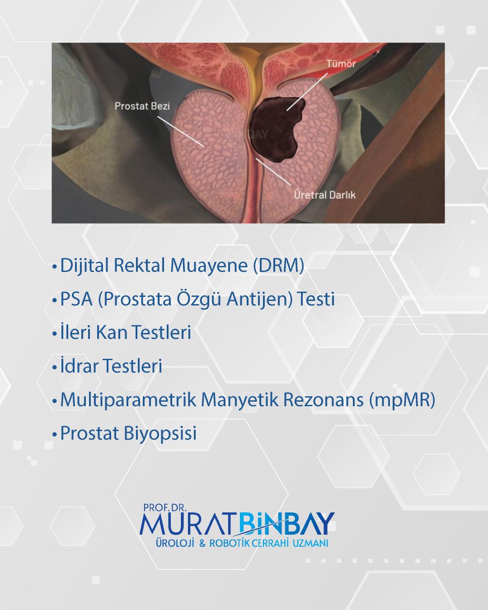 DrMuratBinbay's tweet photo. Prostat kanseri tanısı tek bir testle konmaz.
👉 PSA
👉 Muayene
👉 MR
👉 Gerekirse biyopsi
Hepsi birlikte değerlendirilir.
Doğru tanı = doğru tedavi
#prostatkanseri #üroloji https://t.co/Qga9XukYAs