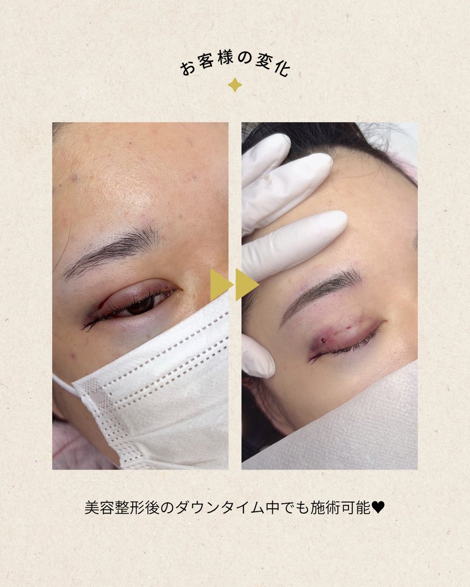 リエルアートメイク(狎鴎亭店)|韓国アートメイク tweet media