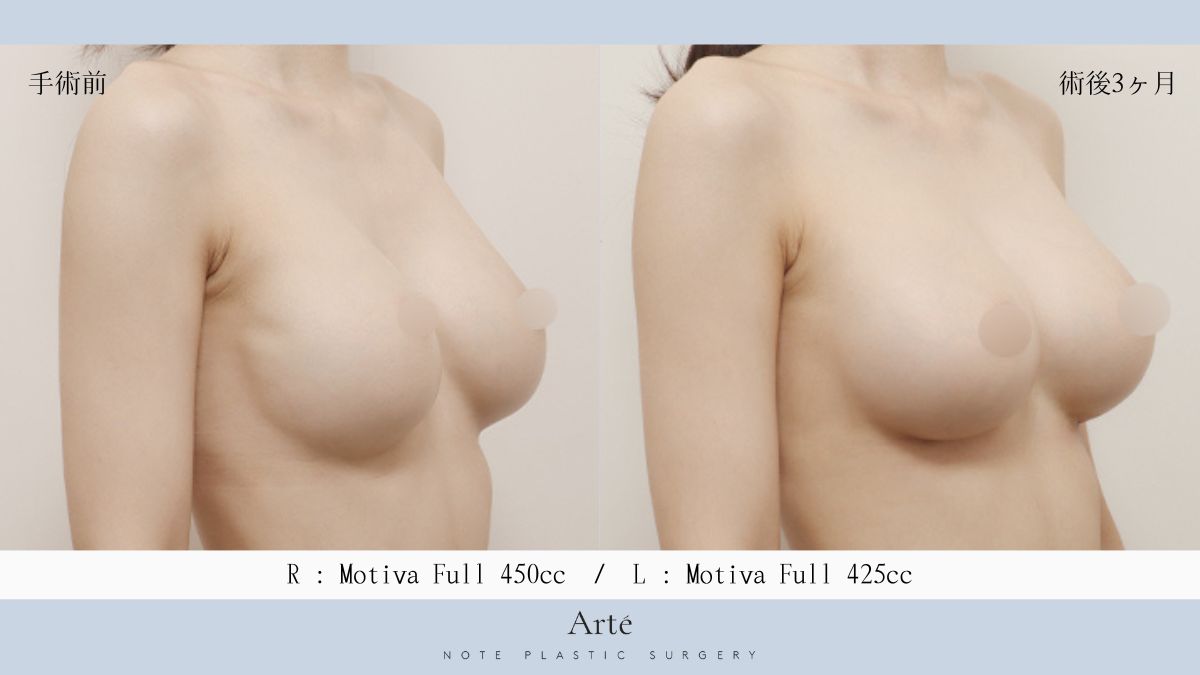韓国ノート美容外科 豊胸センターArté tweet media