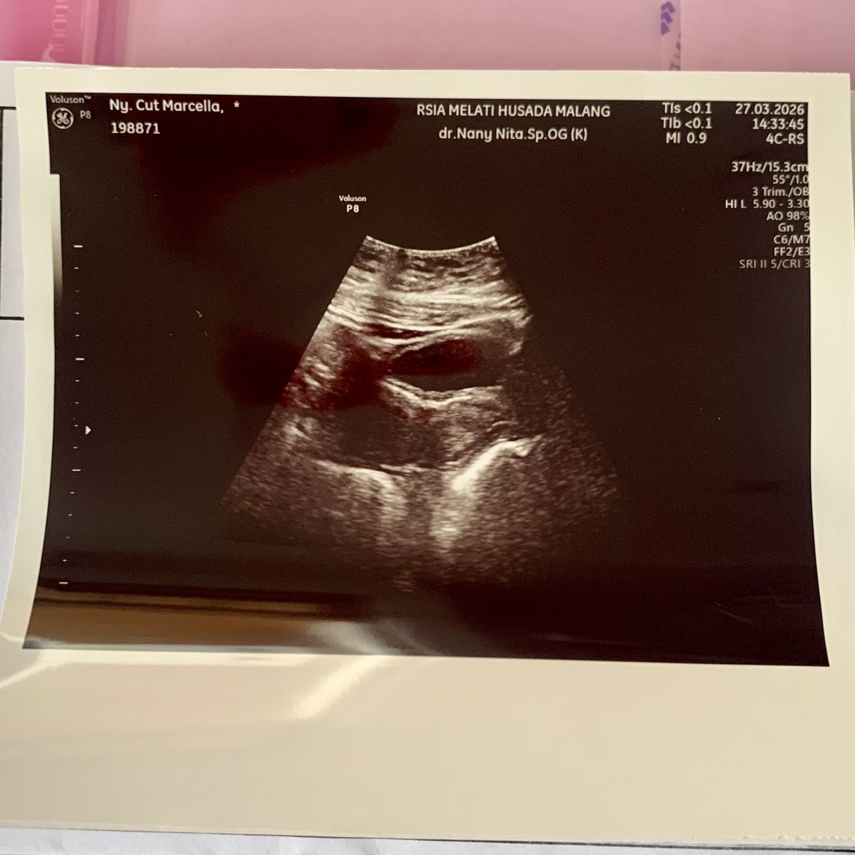 첼 | cella 🐻❄️ tweet media