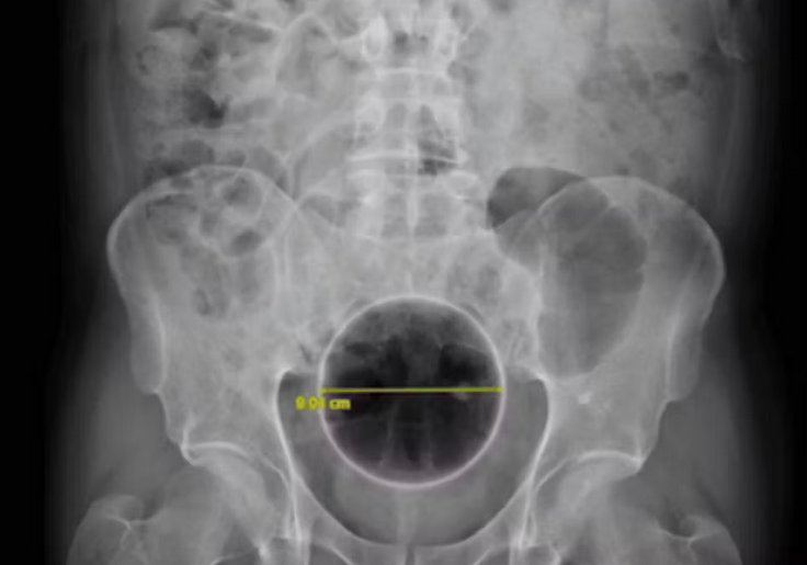 Marc Gozlan tweet media