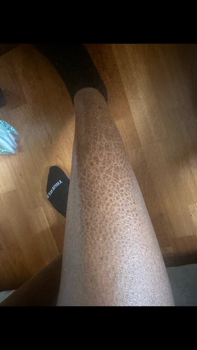 Skin Care Bully tweet media