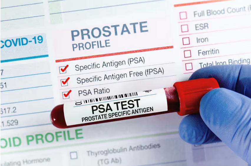 Grupocryo's tweet photo. Tratamiento focal con electroporación irreversible preserva funciones urinarias y sexuales en cáncer de próstata ¡hoy disponible en México!

https://t.co/MNaQ9Zx2dG

#electroporacion #IRE #próstata #cáncerdepróstata #ablación  #medicina #salud https://t.co/UNjQyVQ0FD