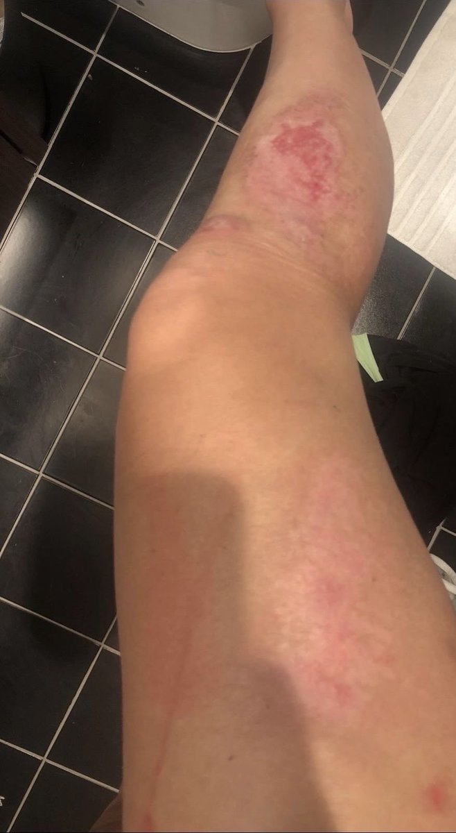 🌹TINYVOICE🌹 tweet media