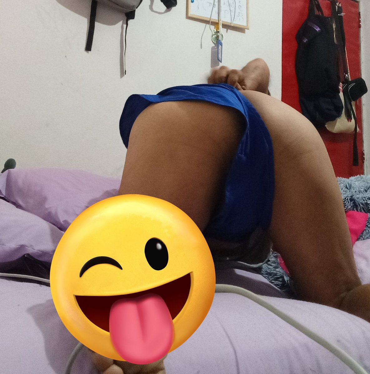 Juanngelvi33848's tweet photo. Después de ser deslechada ....así quedo https://t.co/rciy5FncHn