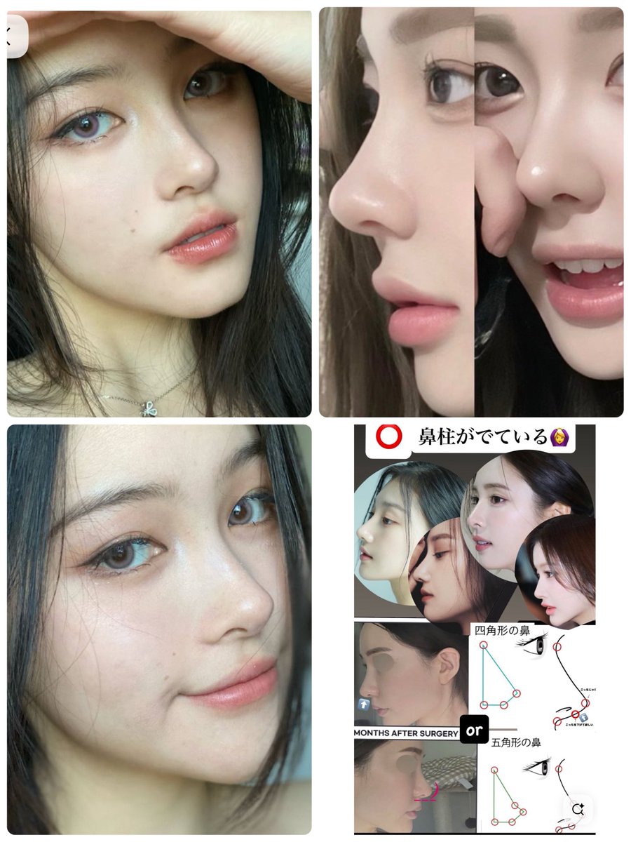 biyouuuu20's tweet photo. 私が👃施術を決めたクリニックは
「狎鴎亭」にある「セギム美容外科」です🏥
なりたく無い鼻🙅‍♀️
・派手すぎる鼻・尖りすぎな鼻・細すぎる鼻筋・アップノーズすぎる鼻・アバター鼻
なりたい鼻🙆‍♀️
・高すぎない鼻・丸い鼻先・ゆるやかなカーブのある鼻・可愛らしさが残る鼻

画像参考⬇️
#渡韓
#鼻フル整形 https://t.co/rPZdaz88wn