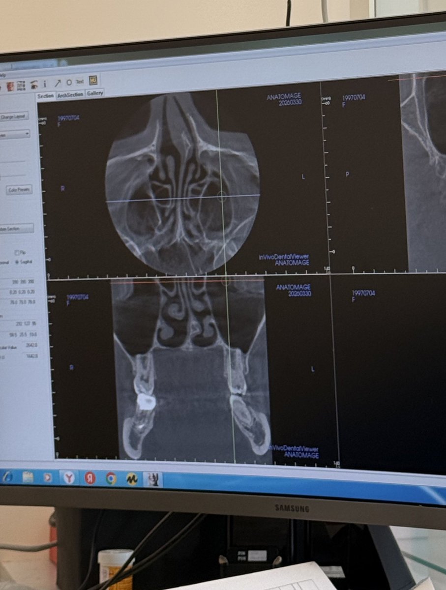 Lera Kent с ментолом tweet media