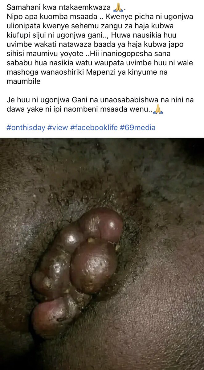 Ebrah Axel tweet media