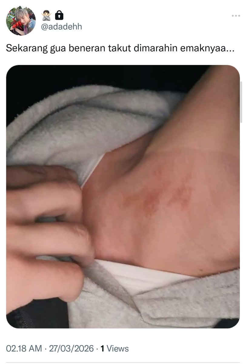 Ichiii☆𖹭.ᐟ🗝️(rest) tweet media