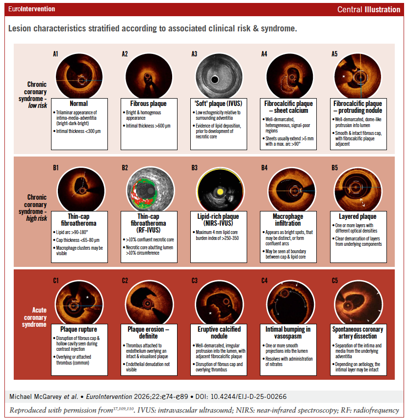 EuroIntervention tweet media
