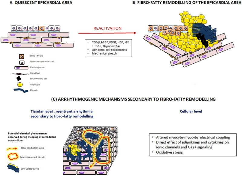 PatientCV's tweet image. Risk of fatal myocarditis increases with every covid #mRNA dose.  

"Myocarditis induced by the Spike Protein has been shown to induce mid to epicardial lateral wall fibrosis – an arrhythmogenic zone."

Explains sudden cardiac deaths. Read more:
wmcresearch.substack.com/p/spike-protei…