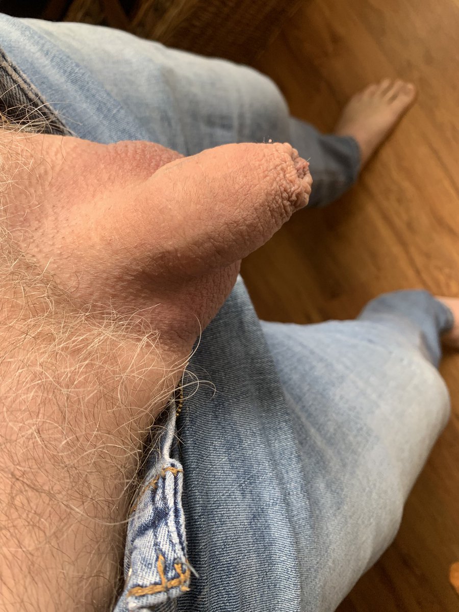 Think anyone will notice the bulge. Perhaps I should leave it out