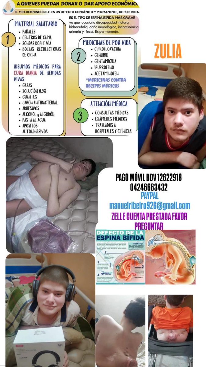 manuel02101's tweet photo. Hola 👋 por favor dame RT y LIKE para que mí caso llegue a más personas y así poder conseguir algunas ayudas necesarias para poder mantener mi calidad de vida. AMERITO TRATAMIENTO DE POR VIDA. Agradezco a quienes puedan ayudar, muchas gracias de antemano 🙏. https://t.co/wjFnrqpLJm