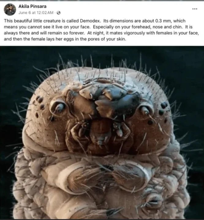 UnrealPOV's tweet image. You are not alone. 😨🛑

​Meet Demodex, the microscopic creatures living in your pores right now. 

They mate, lay eggs, and die on your face.

#Microscopy #Biology #HiddenWorld