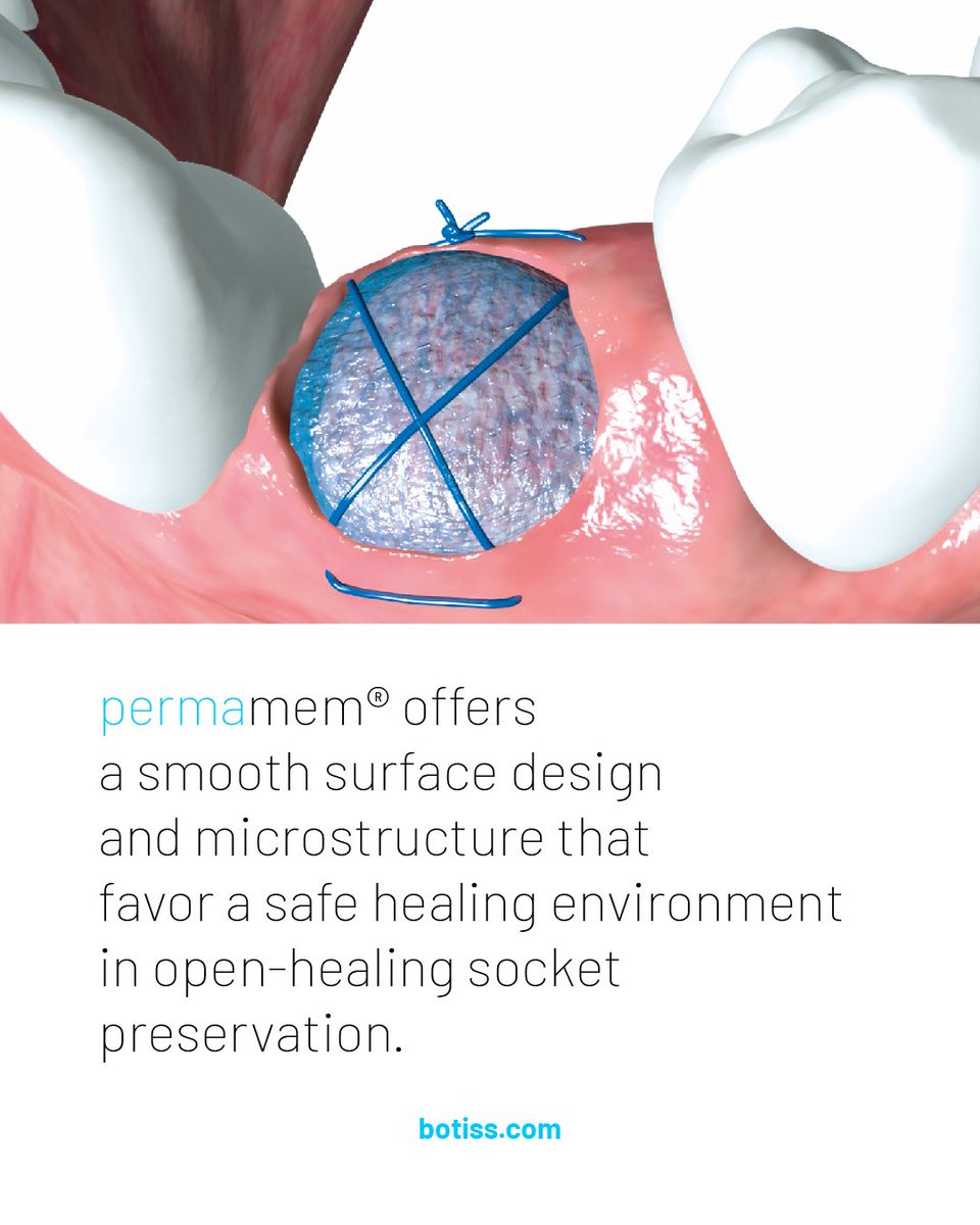 botiss biomaterials tweet media