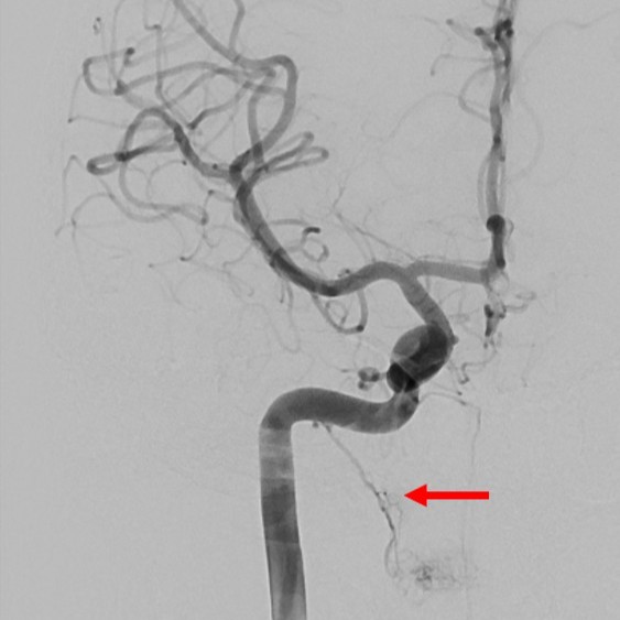 SNIS Info tweet media