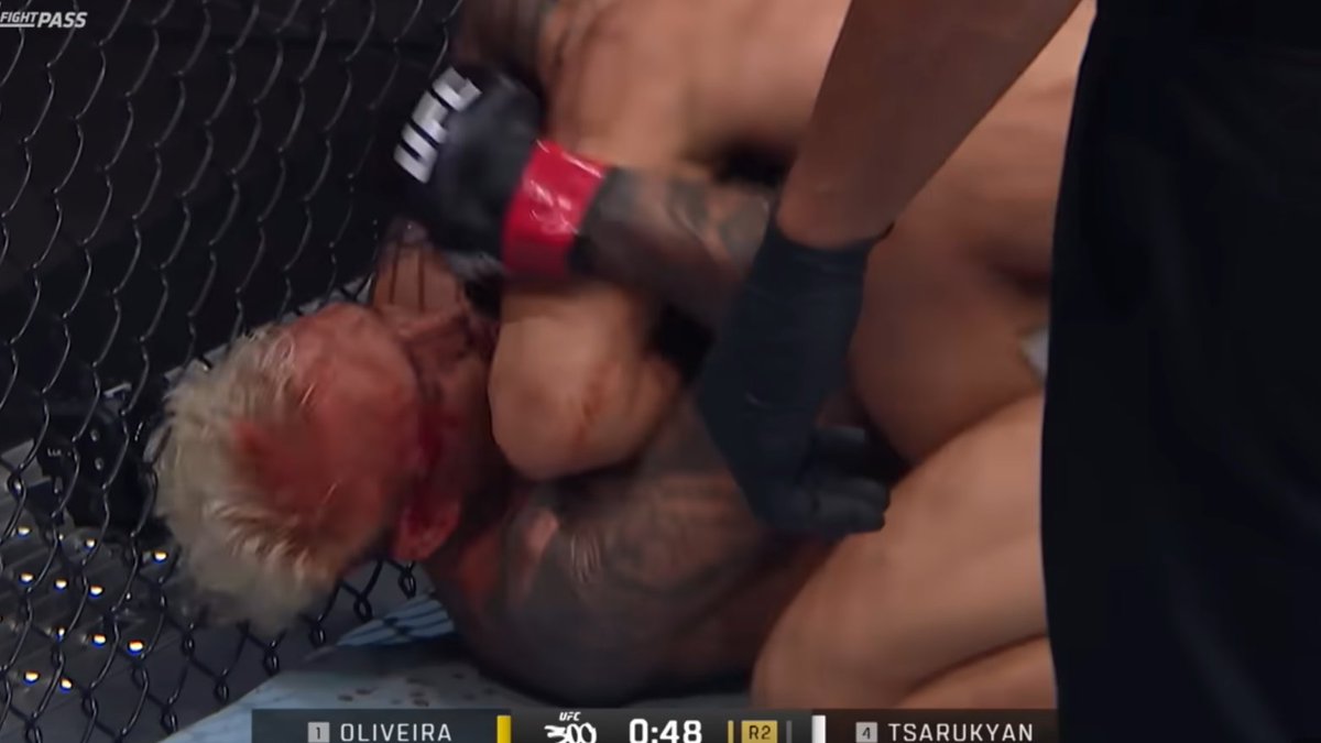 ZKO 🇦🇷 tweet media