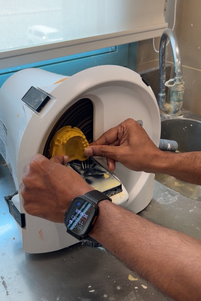 عودة الكاست للساحة