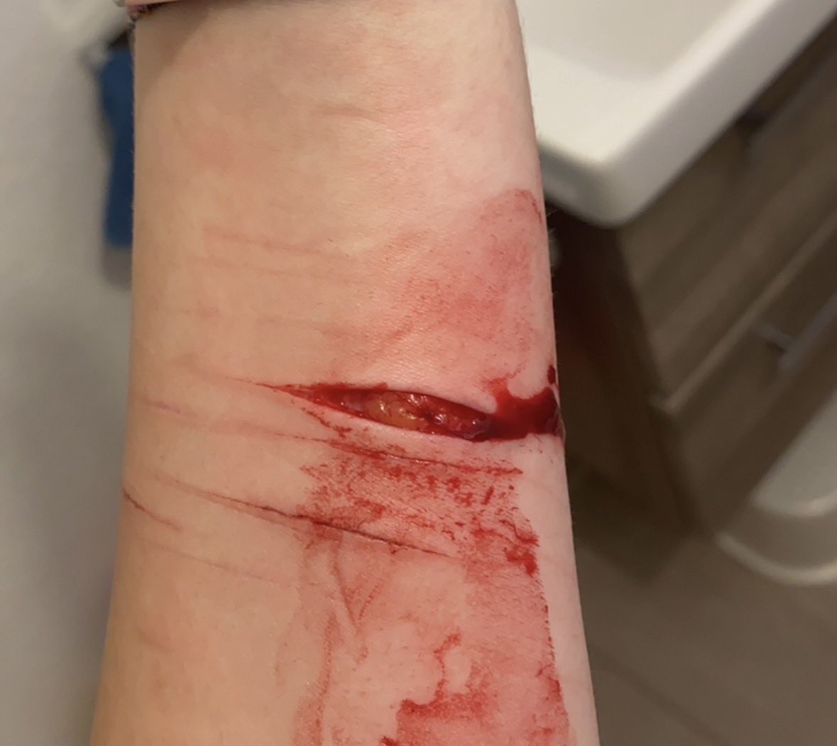 𝚍𝚎𝚏𝚝𝚘𝚗𝚎𝚜𝚕𝚞𝚟𝚛 𝚌𝚑𝚎𝚛𝚛𝚢/𝔰𝔥𝔱𝔴𝔱 tweet media