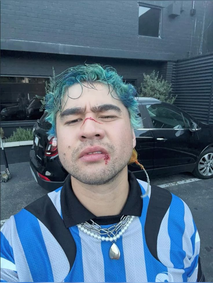SWCCTDRCMS's tweet photo. Welcome to; is it makeup or did i actually fall and bust my ass? https://t.co/t5PJTDFufx