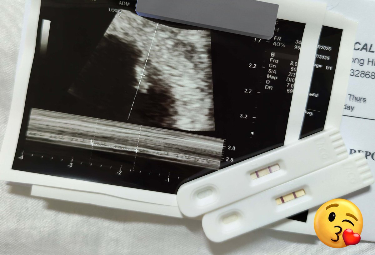 ᴍɪɴᴀ⁷ 🪭 tweet media