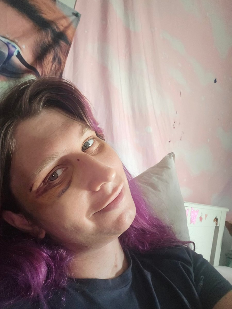 Bambi Attack! tweet media