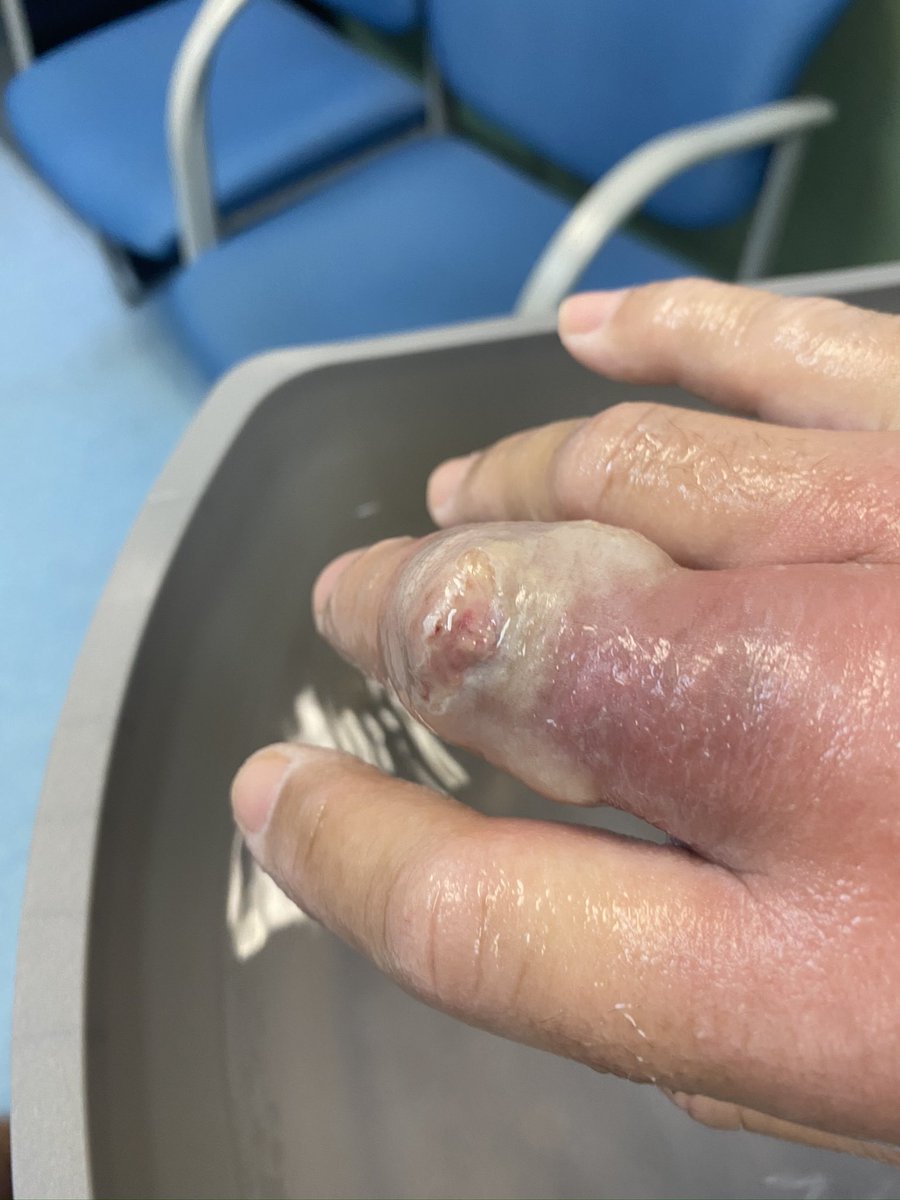 Peter Bonner tweet media