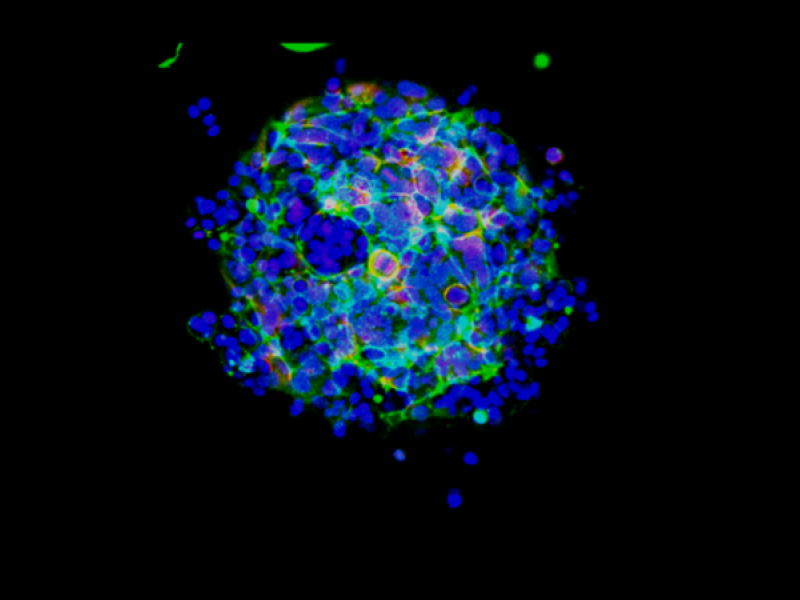 ORNLIsotopes's tweet photo. .@ORNL is powering the fight against cancer through domestic #isotope production and research. Cutting-edge science done at the lab is shaping the future of precision medicine and cancer treatment. https://t.co/mDbPEwMQeo https://t.co/M6y5OdH7JZ