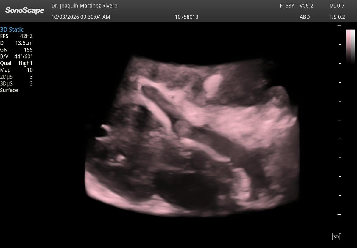 Joaquín Martínez tweet media