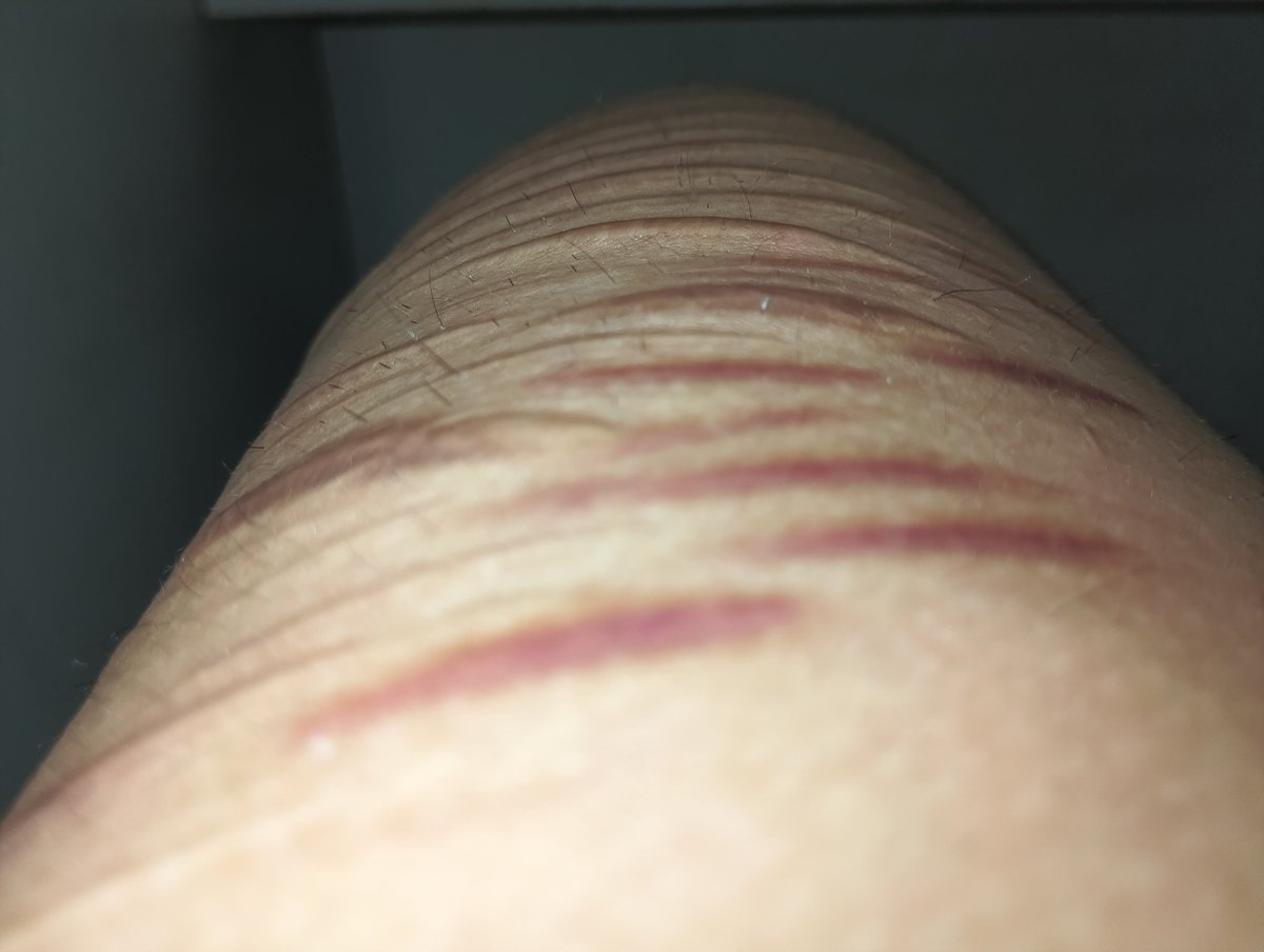 myra :p (wanderer of SHittEDtwt) tweet media