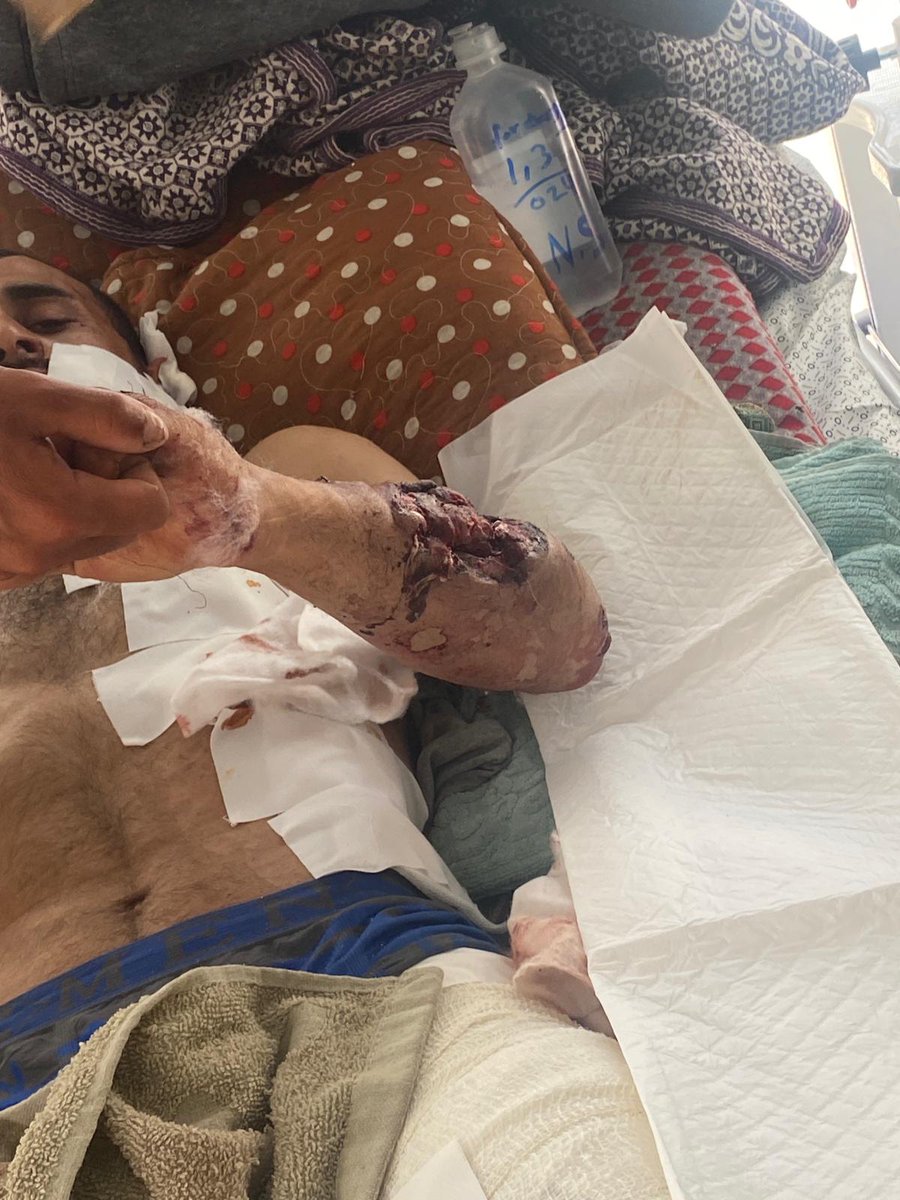 Adham from Gaza 💔 tweet media