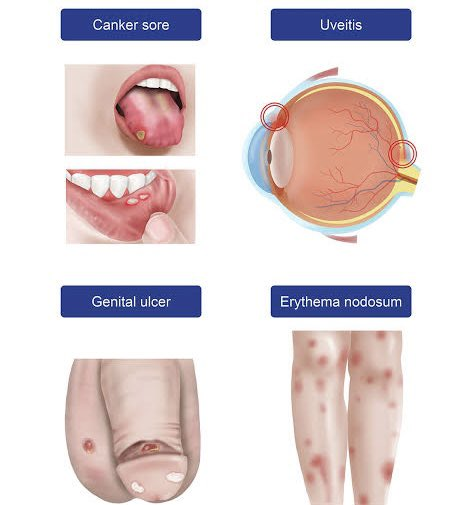 احمد tweet media