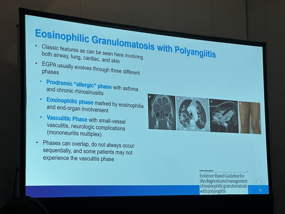 MSHSDerm's tweet image. “CrossTalk: Interdisciplinary Dermatology Made Simple: Pulmonary &amp;amp; Allergy” Dr. Jordan Talia discussed
Multisystem conditions—Hypereosinophllic syndromes, Eosinophilic Granulomatosis w- Polyangiitis, &amp;amp; their therapeutics at #AAD2026 #Denver  #complex
#dermatology @EmmaGuttman