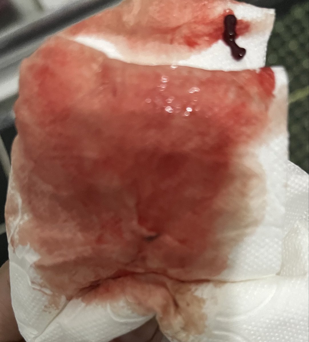 yogasu🌱🥑🍉🧆☀️🧘‍♀️🌿 tweet media