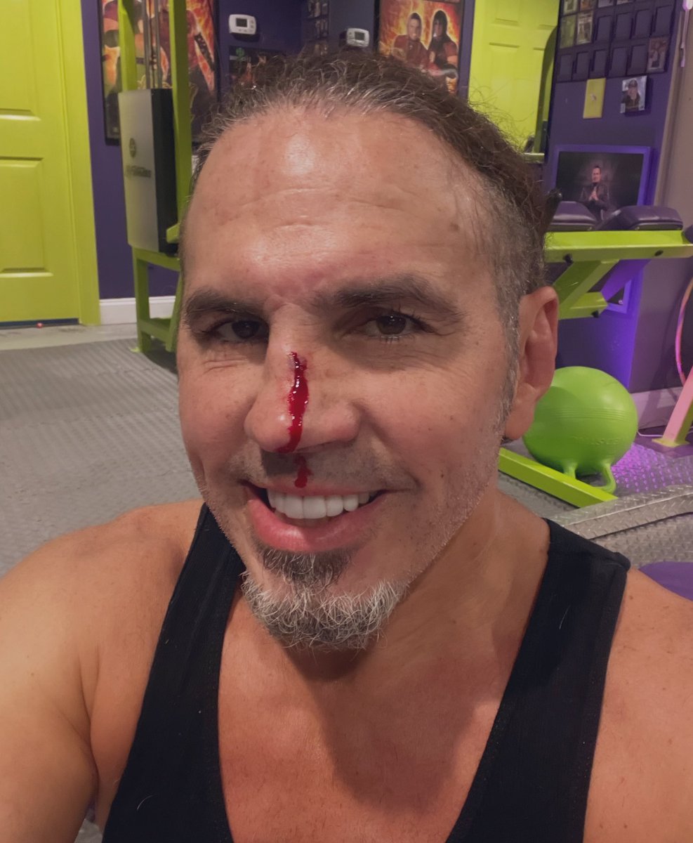 MATT HARDY tweet media