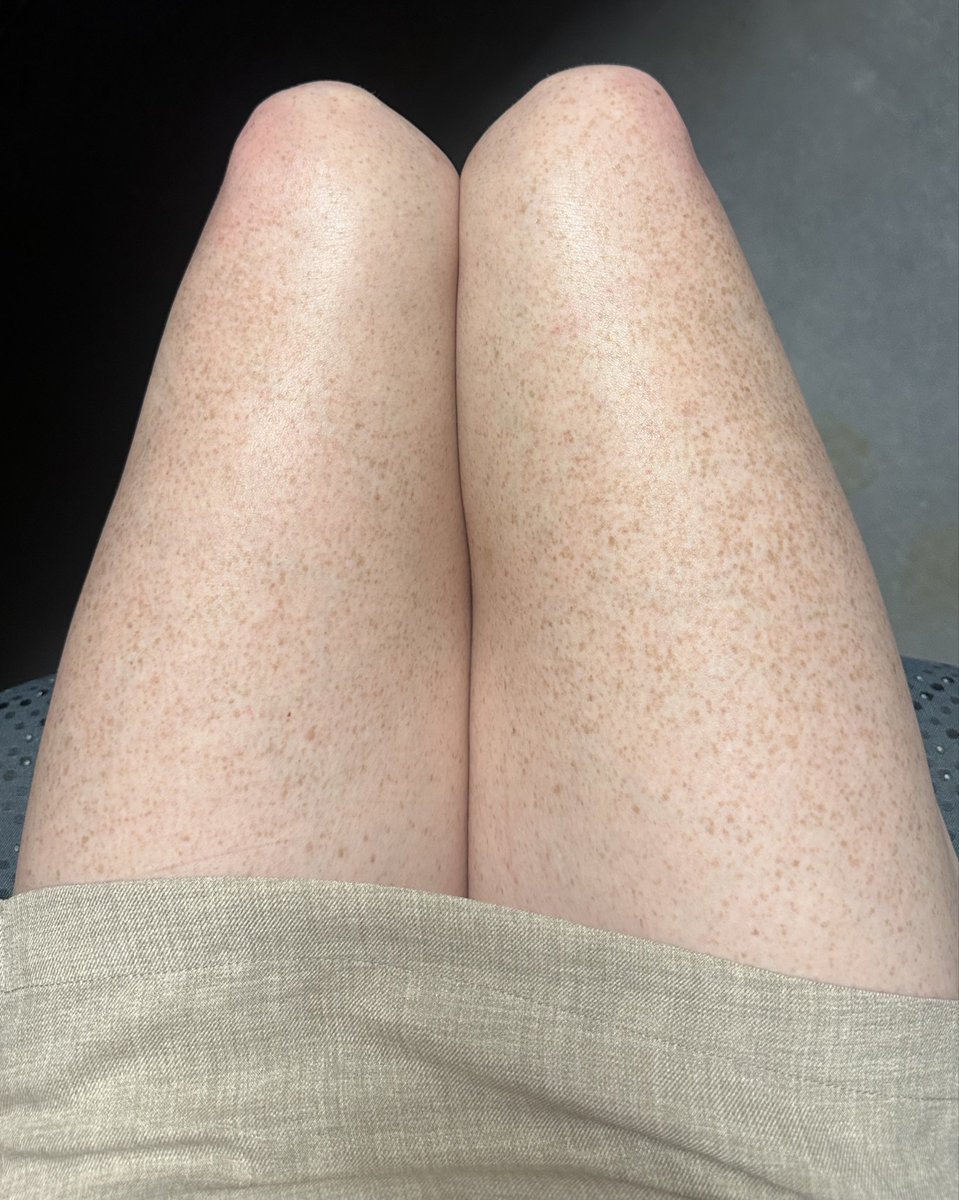 AstroGirl 🌜💨✨ tweet media