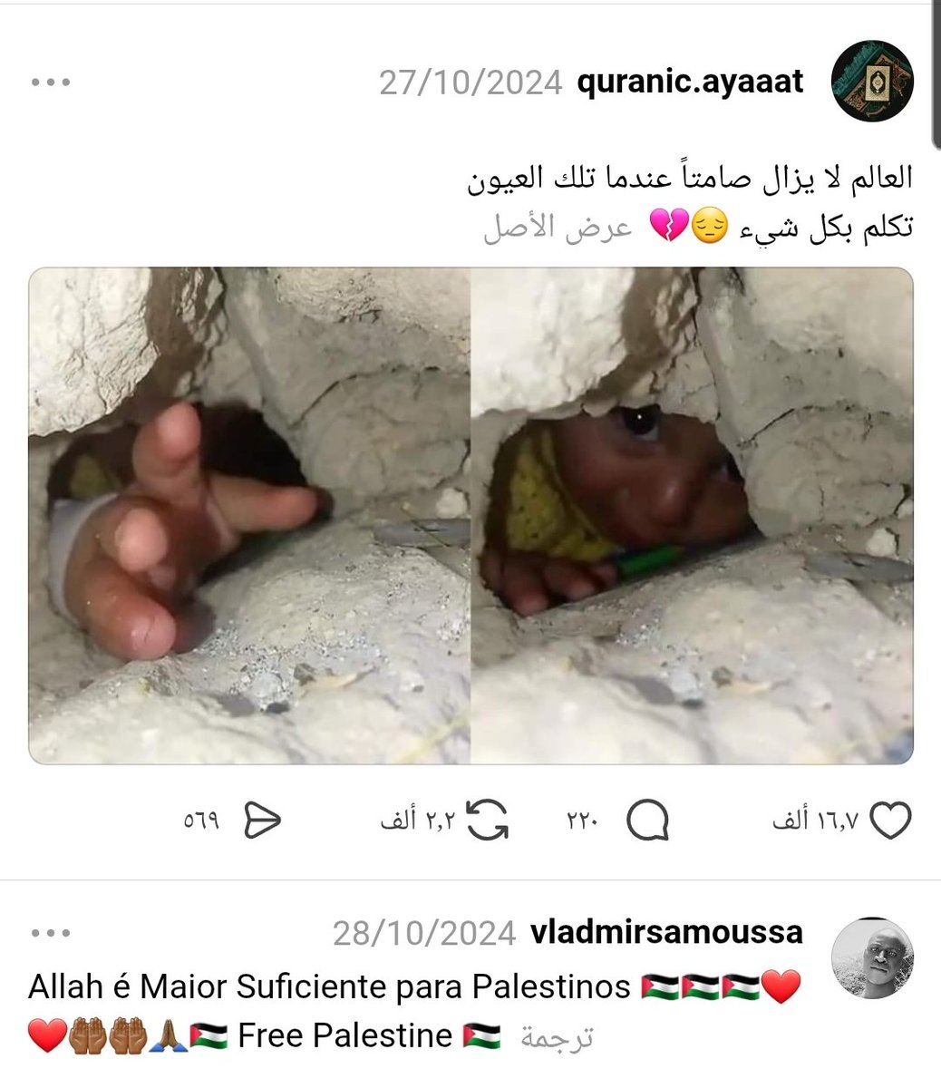ORans2020's tweet photo. @3Qassbbnmuzloh @WMX_MEDIA هذا غير حقيقي 
الصورة لطفل في غزه عام 2024 https://t.co/xqvAKHC94h