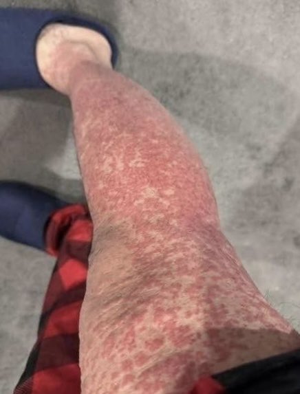 Diego Prieto✈️ tweet media