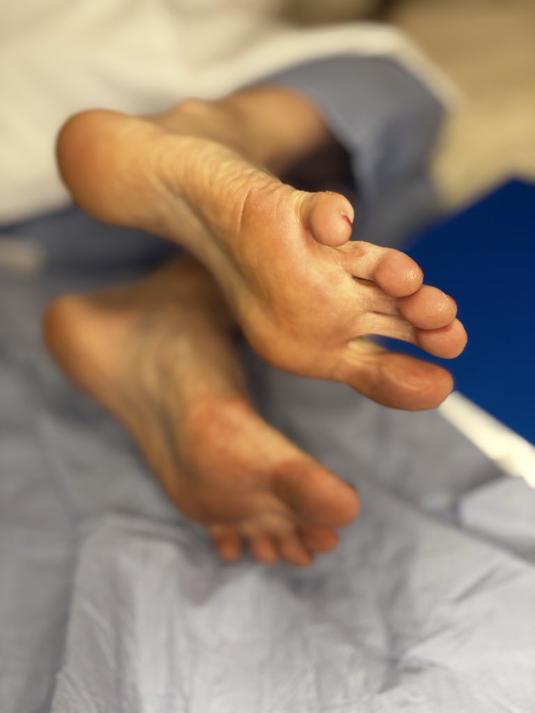 DrFootsyFox's tweet photo. Step into my clinic of desire…
Medical Foot Fetish content for the true connoisseur. Perfect soles, clinical exams, podiatric care with a heavy sensual twist. Premium photos, videos & custom sessions.
If you crave healthy, cared-for feet in a medical setting — you just found your new obsession. DM for inquiries.

#MedicalFootFetish #FootFetish #PodiatryFetish #ClinicalFeet #FootCareFetish #SoleObsessed #MedicalFetish #FeetLovers #PodiatristFetish #FootWorship