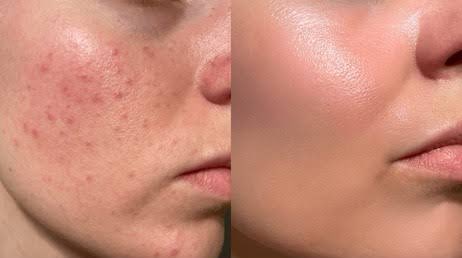 Farving🙆⭐️ tweet media