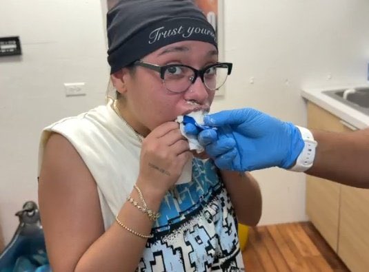 yo feliz pensando q se quitó los braces pero posiblemente sean los protectores bucales de la velada…