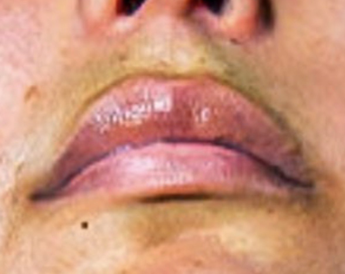 Reinaldo “El Yayo” Varas. tweet media