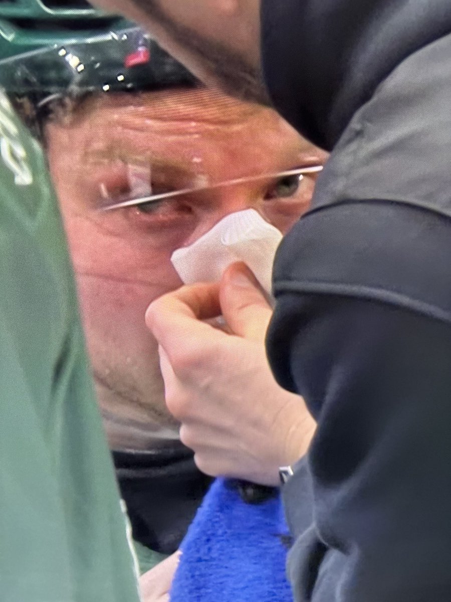 Filip Borgman tweet media