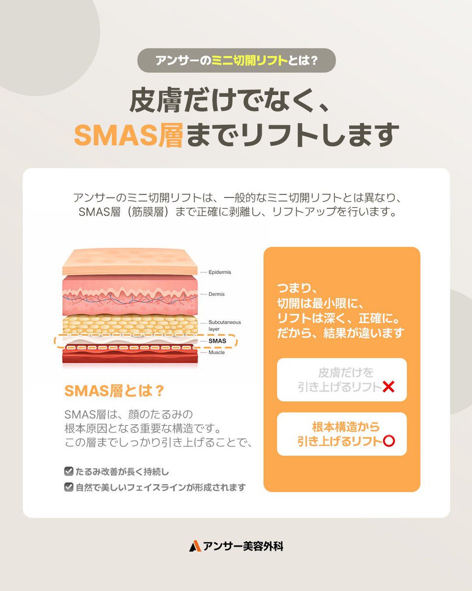 垢抜けメモちゃん tweet media